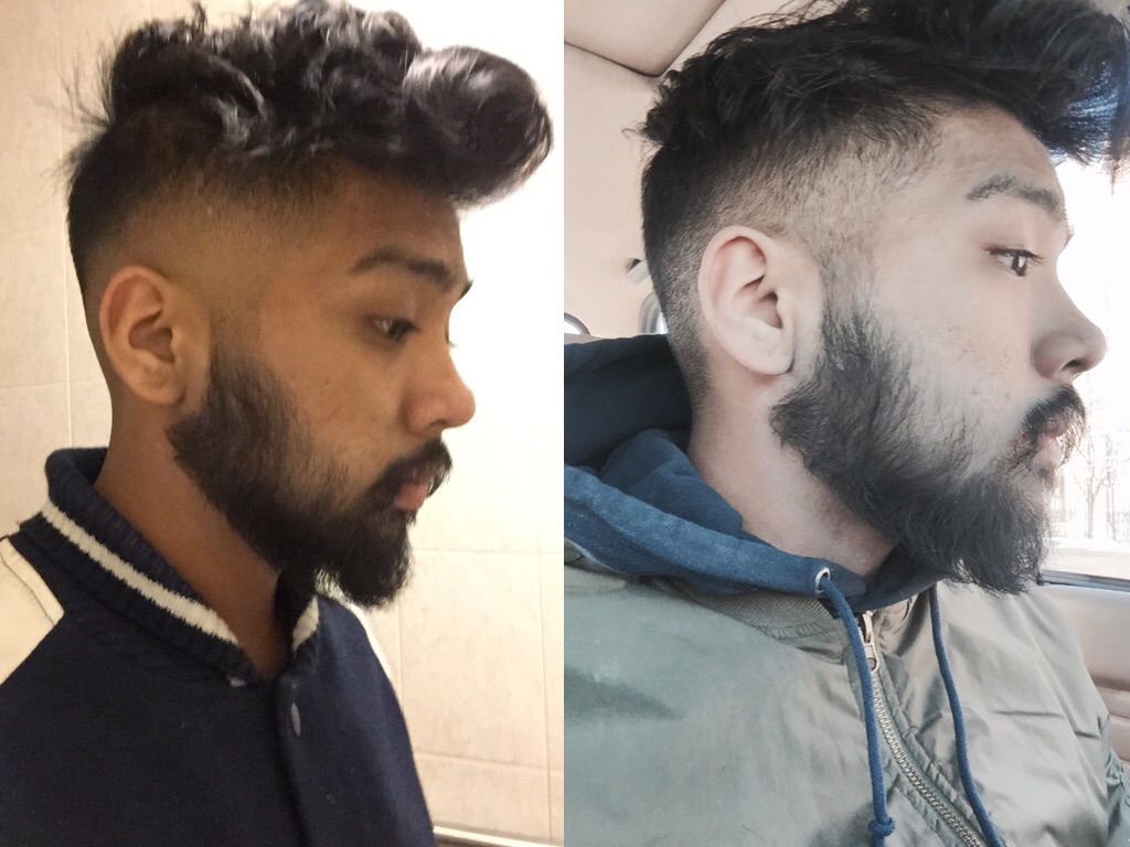 Minoxidil Before And After Beard Result / minoxidil beard / Another