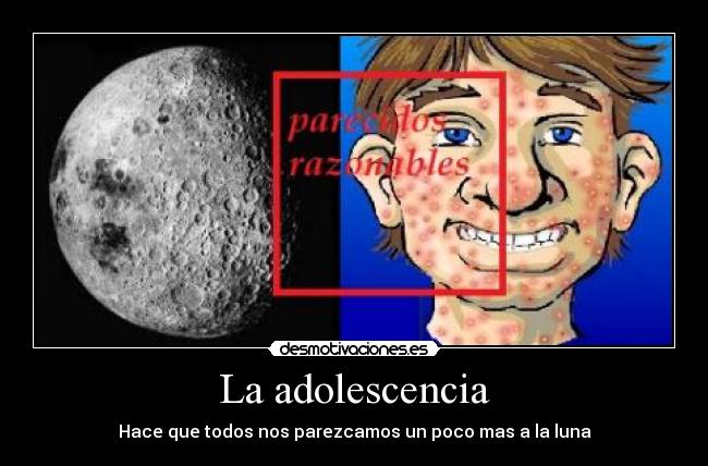 La adolescencia - Hace que todos nos parezcamos un poco mas a la luna