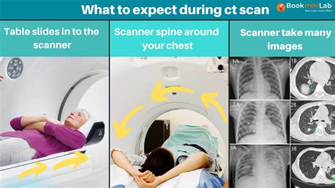 CT Scan Chest: Purpose, Results, COVID-19 & Cost [2024]