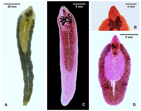 Platyhelminthes Trematoda Fasciola Hepatica