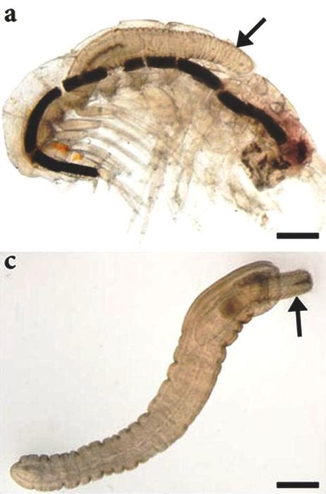 Parasite of the Day: Acanthocephalus rhinensis