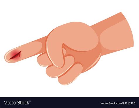 Isolated hand open wound Royalty Free Vector Image | Vector, Clipart, Manos