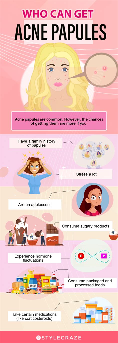 Acne Papules – Potential Causes & How To Get Rid Of Them