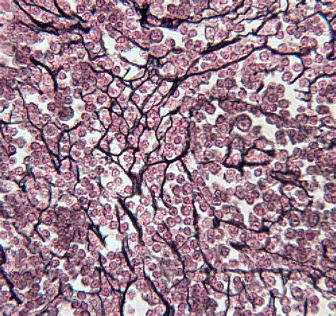 Reticular Fiber Histology