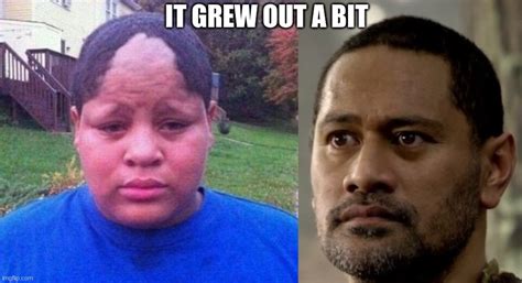 Bad Hairline Memes - Knockin Jokes