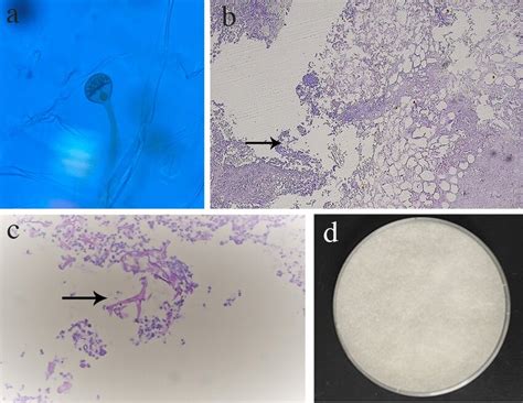 a Slide culture microscope showed spherical sporangia contains numerous ...