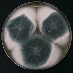 Aspergillus fumigatus - Allergy, Symptoms, & Treatment | Mold Busters