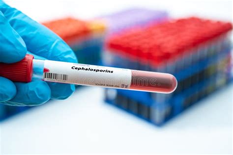 Cephalosporins Allergy Blood Test. Test Tube in Doctor Hand Stock Image ...