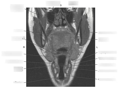 Laryngopharynx Diagram | Quizlet