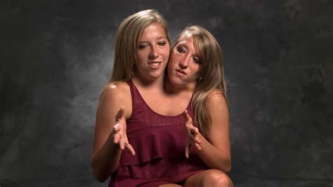 Conjoined twins abby and brittany - singaporelasopa