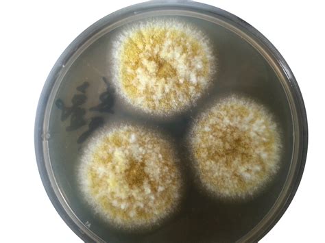 Aspergillus flavus on Czapek Dox agar: Introduction and colony