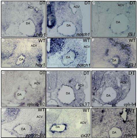 Arterial markers are expressed in all endothelial cells while venous ...