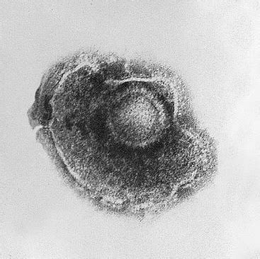 Category:Varicellovirus - Wikimedia Commons