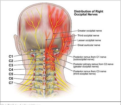 Headache and neck pain: is it possible that nerve compression is to ...