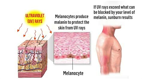 Ultraviolet Rays Effects On Humans