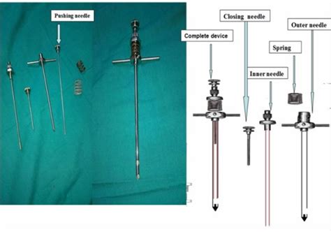 Diagnostic yield of the new pleural biopsy needle ((Esmat's needle)) in ...