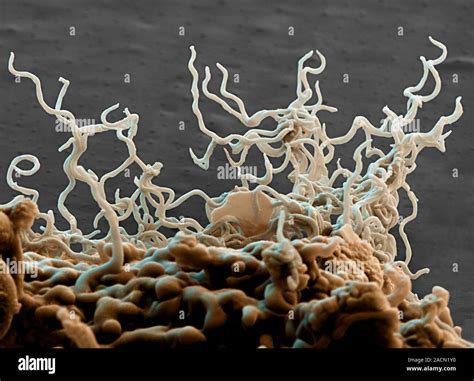 Lyme disease bacteria. Coloured scanning electron micrograph (SEM) of ...