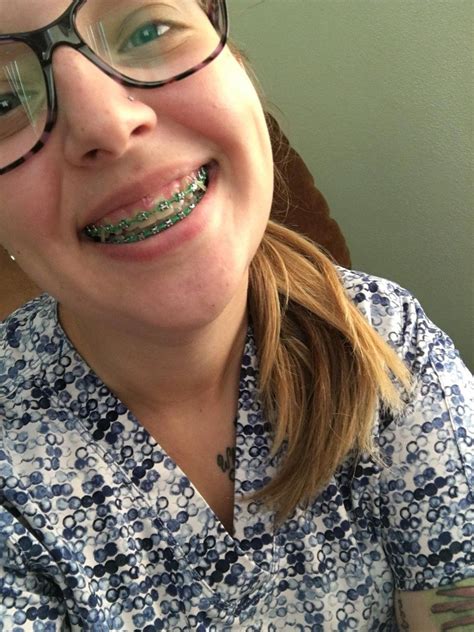 #braces #girlswithbraces #metalbraces #glasses #glassesandbraces # ...