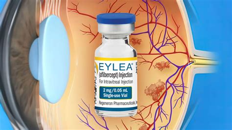 Eylea And Eylea HD Injection: Uses, Dosage Side Effects, 46% OFF