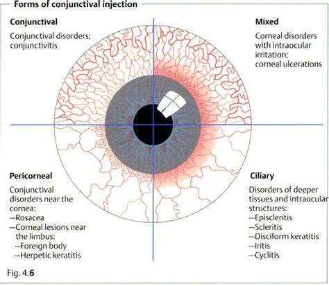 The Red Eye - Critical Care Collaborative