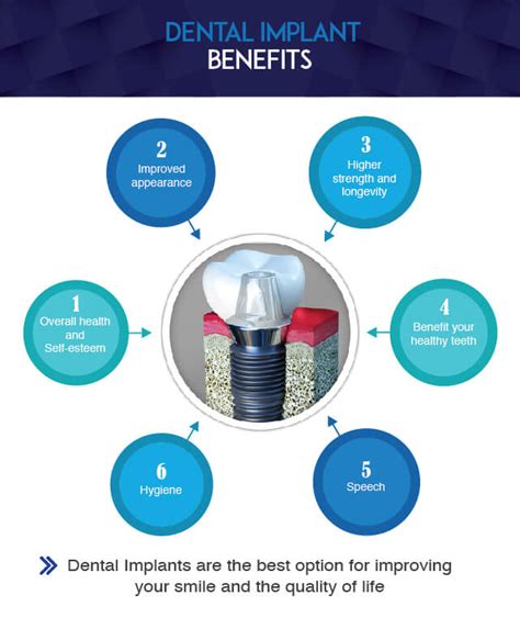 Dental Implants: What Are The Benefits and Disadvantages