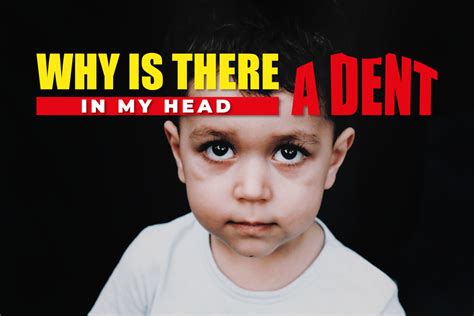 Why Is There A Dent In My Head - Exploring The Causes And Treatments