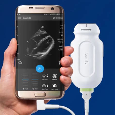 Hand-held ultrasound system - Lumify - Philips Healthcare - for ...