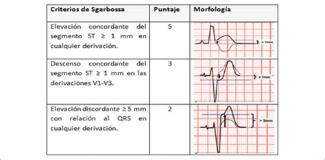 SICA diagnóstico Flashcards | Quizlet