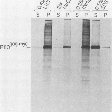 Effects of DNase I and RNase A treatment on retention | Download ...