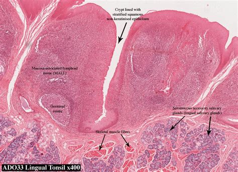 palatine tonsil histology - Google Search