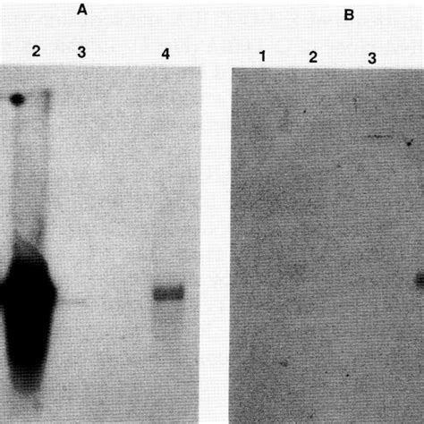 Northern blot hybridization of RNAs from the different stages of ...