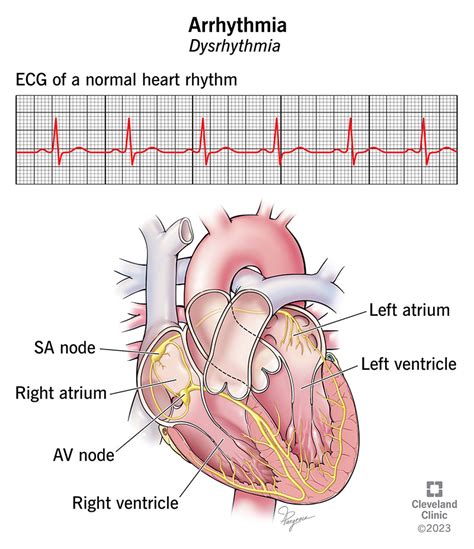 Critical Care Cardiac Heart Beat