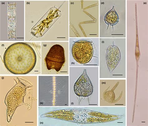 Examples of phytoplankton cells, their shape and elongation class. (a ...