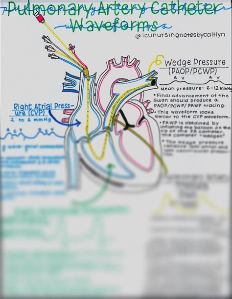 Hemodynamic/swan-ganz Catheter Waveforms - Etsy Hong Kong