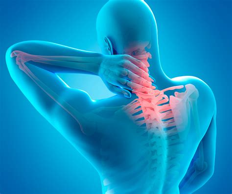 Can Chiropractic Help Arthritis In The Neck | Sonnier Chiropractic Clinic