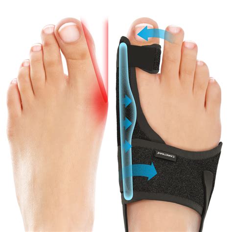 Caretras Bunion Corrector, Orthopedic Bunion Splint, Big Toe Separator ...