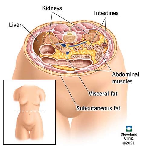 Visceral Fat: What It is & How to Get Rid of It