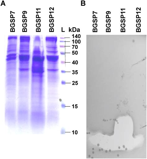 SDS-PAGE gel electrophoresis of proteins precipitated from supernatant ...