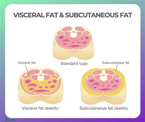 VISCERAL FAT - Why is Visceral Fat Dangerous to You and 12 Tips to Get ...