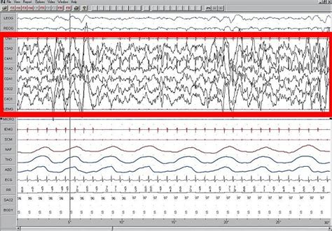 5 Strong Delta Waves Music Benefits & Side Effects [Don't Ignore Them]