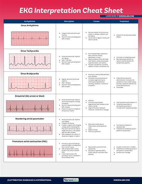 practice ekg rhythm strips for acls