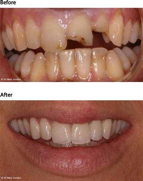 Before and After Dental Cases