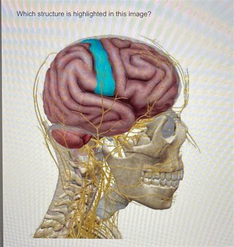 Solved Which structure is highlighted in this | Chegg.com