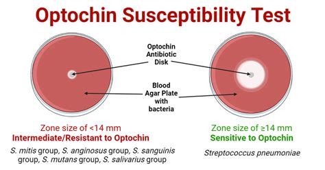 Optochin Susceptibility Test- Principle, Procedure, Results