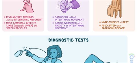 Tremor (hands) – causes, types of hand tremors, treatment – Healthy ...