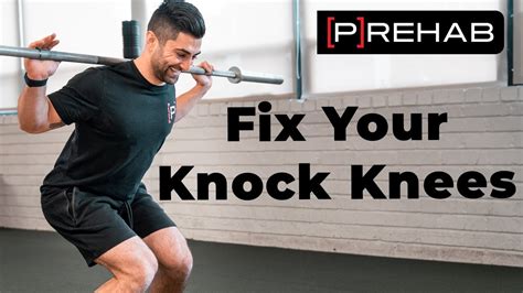 Fixing Your Knock Knees With Two Exercises - YouTube