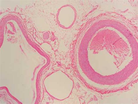 Vein and Artery histology Diagram | Quizlet