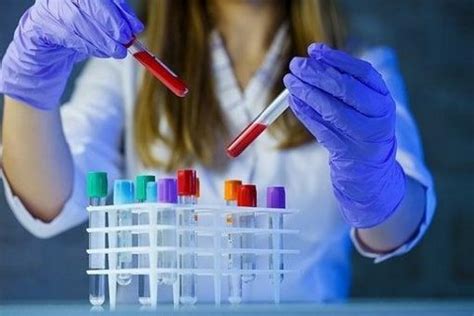 The Fastest Way to Speed Up the Production of Antibodies - Biomatik