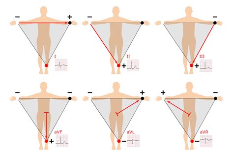 12 Lead Ecg Limb Electrode Placement