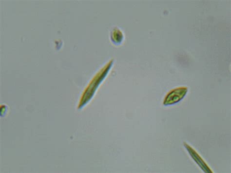 Amateur Algae culturing and cultivation : Ankistrodesmus acicularis for ...